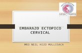 Expo embarazo ectopico cervical 2015