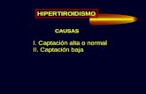 10. hormona tiroidea