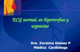 Curso ECG_3 Normal, Hipertrofias y Urgencias
