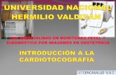Introduccion a La Cardiotocografia