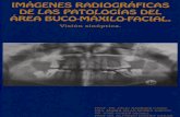 Imágenes Radiográficas de Las Patologías Del Área Buco-Maxilofacial