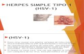 Herpes Simple Tipo 1
