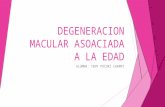 Degeneracion Macular Asociada a La Edad