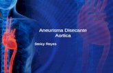 Aneurisma Disecante Aortica