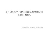 Litiasis y Tumores Aparato Urinario
