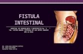 Fistulas Intestinales