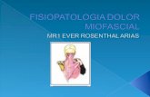 Fisiopatologia Dolor Miofascial