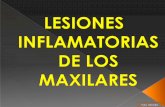Lesiones Inflamatorias de Los Maxilares