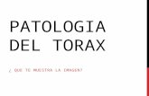 Patologia Del Torax