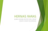 Hernias Raras