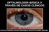 Oftalmología Básica a Través de Casos Clínicos-1