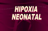 Hipoxia Neonatal