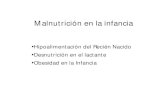 Malnutricion Infantil en Aps - Ernesto Nuñez