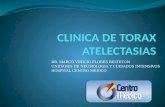 Clinica de Torax Atelectasias 2012