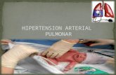 6 Hipertension Arterial Pulmonar