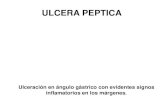 ULCERA PEPTICA-Nov2014.pdf