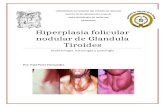 Hiperplasia Folicular Nodular de Glandula Tiroides