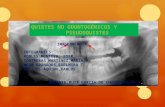 Diapo de Quistes Odontogenicos