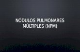 Nódulos Pulmonares Múltiples (NPM)