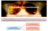 NEUMO-TUMORES PULMONARES