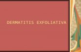 7 Dermatitis Exfoliativa