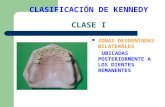 CLASIFICACIÓN DE KENNEDY 1