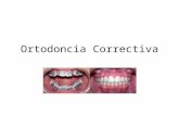 Ortodoncia Correctiva