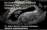 141889550 Ecografia Normal Del Embrion de La Semana 0 6 Ppt