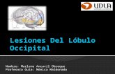 Lesiones Del Lóbulo Occipital