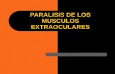 Paralisis de Musculos Extraoculares