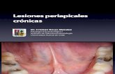 Lesiones Periapicales Cronicas 2013