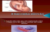 Placenta previa.ppt
