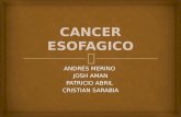 Cancer esofagico