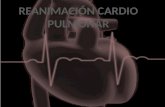 Reanimación Cardio-Pulmonar