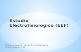 Estudio Electrofisiológico (EEF) About Angio