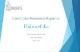 Hidrocefalia RM - Gina Rocha