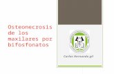 Osteonecrosis y bisfosfonatos