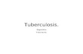Tuberculosis.diag y Trat
