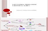 Leucemia Mieloide Crónica (LMC)
