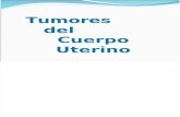 Tumores Del Cuerpo Uterino 2015