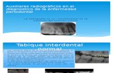 Auxiliares Radiográficos en El Diagnostico de La Enfermedadperiodontal