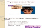 Tripanosomiasis Final