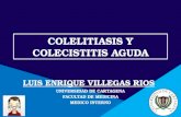 Colelitiasis - ColecistitisGGG