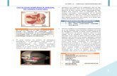 16 - Patologia Quirurgica Sinusal de Origen Dentario
