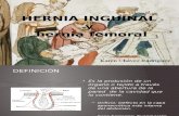 Hernias inguinales y femorales