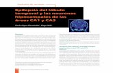 La epilepsia del lóbulo temporal y las neuronas hipocampales de las áreas CA1 y CA3