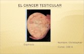 Nombre: Christopher Espinoza Curso: 100 A. ¿Qué es el Cáncer testicular? El cáncer de testículo es un tipo de cáncer que generalmente se origina en el.