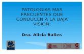 PATOLOGIAS MAS FRECUENTES QUE CONDUCEN A LA BAJA VISION: Dra. Alicia Balier.
