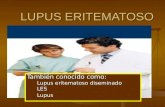 LUPUS ERITEMATOSO También conocido como: Lupus eritematoso diseminado Lupus eritematoso diseminado LES LES Lupus Lupus.