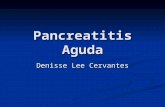 Pancreatitis Aguda Denisse Lee Cervantes. Definición “Proceso inflamatorio del páncreas que puede involucrar tejidos peripancreáticos y/o sistemas orgánicos.